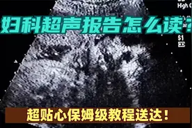 妇科超声报告怎么读？超贴心保姆级教程送达！视频封面