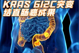 KRAS G12C突变结直肠癌最新成果视频封面