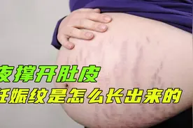 为什么妊娠纹会突然冒出来？一分钟了解妊娠纹形成，妈妈们辛苦了视频封面