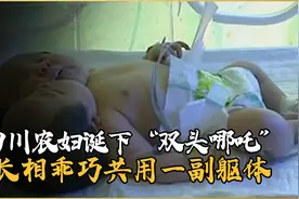 四川农妇诞下“双头哪吒”，长相乖巧共用一副躯体，医生：造孽啊视频封面