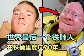 什么是铁肺？为何有些人要一辈子在铁桶里度过视频封面