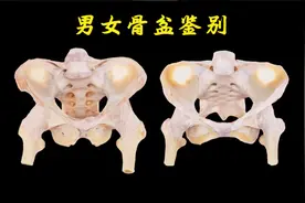 鉴别男、女骨盆