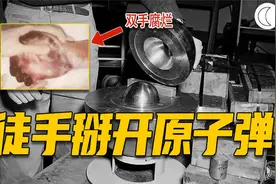 徒手掰开原子弹会怎样？史上前2位临界事故遇难者，肌肉溶解而死