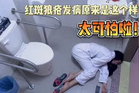 红斑狼疮发病原来是这个样子，太可怕了！愿女神一路走好！视频封面