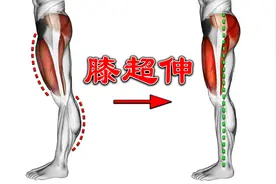 矫正膝超伸最好的训练，每天一练，2周见效视频封面
