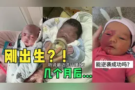 刚出生奇丑无比的宝宝，差点被扔掉，没想到后来越长越好看了