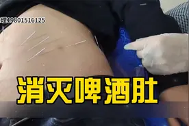 啤酒肚怎么减最快最有效？王瑞雪汉传针雕教学视频全集视频封面