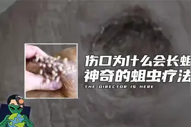 伤口为什么会长蛆？神奇的蛆虫疗法