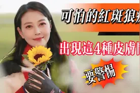 可怕的红斑狼疮！出现这4种皮肤问题要警惕!视频封面