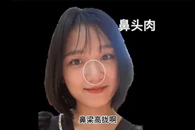 鼻肉多的人，主富！鼻骨高的人，主贵！天生富贵的面相！