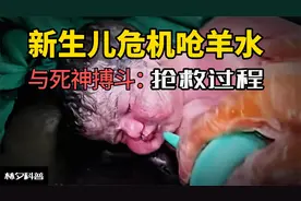 新生儿呛羊水，刚出生呼吸心跳就暂停！全力抢救过程录像视频封面