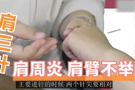 肩周炎，肩膀不举怎么办？董氏奇穴"肩三针"实操教学，三针止痛！视频封面