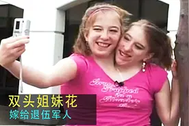 双头姐妹花刚出生，被预言活不了三个月，不料成功逆袭嫁人做妈妈视频封面