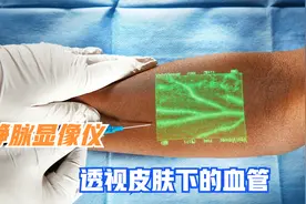 国外发明静脉显像仪，透视皮肤下的血管，新手护士也能一针扎中视频封面