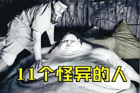 11个样貌奇异的人，若不是亲眼所见，很难相信他们竟真实存在视频封面