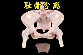 耻骨分离的耻骨联合原来是这样的视频封面