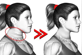 消除颈纹最好的训练视频封面