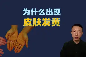 皮肤发黄的5个原因（为什么出现皮肤发黄）视频封面