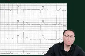 2024年医考，执业医师与助理医师需掌握心电图、技能阅片考题解析