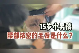 小男孩腰部长有浓密毛发，别忽视！可能是身体发出的“求救信号”