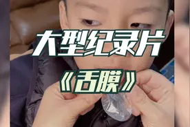 大型纪录片《中药舌膜》，奇葩舌膜出示，舌头和胃对了一晚上的帐视频封面