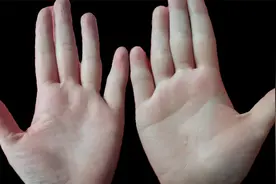 双手才智线上都呈现了一个三角型附着在才智线上，说明易胡思乱想