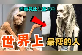 世界上十个最瘦的人，第七名腰围只有50厘米，第一名仅17公斤视频封面