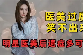 明星医美后遗症多可怕，杨幂下巴惹争议，金晨面部僵硬笑不出视频封面