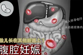 【男人怀孕】也行了？胚胎长在肠子上？【高能预警】视频封面