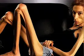 地球上最瘦的女孩，体重仅有15公斤，像一具行走的骷髅视频封面