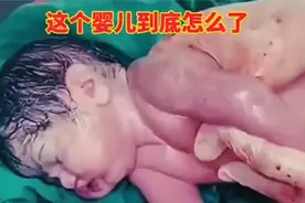 29C66刚出生的婴儿被医生暴打了，看完暖心！视频封面
