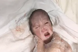 不顾劝阻与反对，奶奶级高龄产妇坚持顺产，结果孩子成了这样视频封面