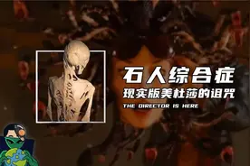 石人综合症，现实版美杜莎的诅咒视频封面