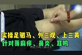 董氏奇穴实操演示（上）：荨麻疹、过敏性鼻炎、耳鸣实操教学！