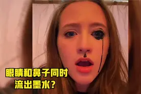 当不小心把眼线液画进眼睛里，尽然会出现这样的情况