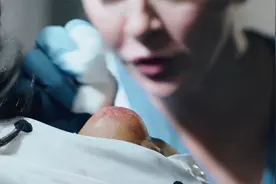 女孩的脖子上长了一颗巨型青春痘视频封面
