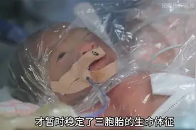 怀孕26周的孕妇生下一对三胞胎，三个新生儿的体重加起来只有五斤视频封面