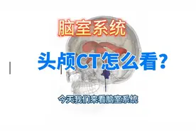头颅CT怎么看-脑室系统视频封面
