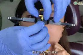 GAMMA解刨式面弓转移视频封面