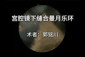 宫腔镜下曼月乐环缝合视频封面