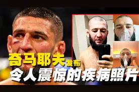 UFC奇马耶夫发布令人震惊的疾病照片，透露“我病的很重”视频封面