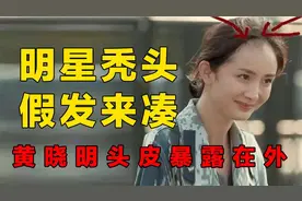 原来明星也“秃头”？黄晓明头皮暴露在外，刘晓庆颜值出卖发量视频封面
