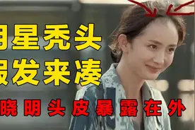 原来明星也“秃头”？黄晓明头皮暴露在外，刘晓庆颜值出卖发量视频封面