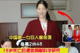 中国第一女巨人曾金莲：身高2米48，18岁死亡后遗体捐献科学研究视频封面