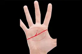 两种假断掌的意义