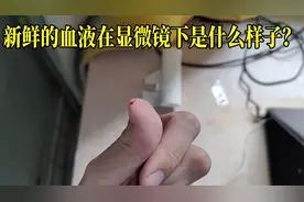 新鲜的人血在显微镜下是什么样子？好多红细胞