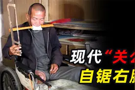 为省百万手术费，河北硬汉自锯右腿，不打麻药咬碎4颗牙！视频封面