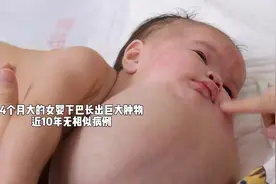 20岁女孩产下畸形胎儿，医生建议放弃，奶奶一番话改变了孩子命运