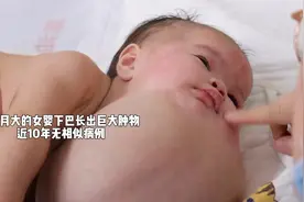 20岁女孩产下畸形胎儿，医生建议放弃，奶奶一番话改变了孩子命运