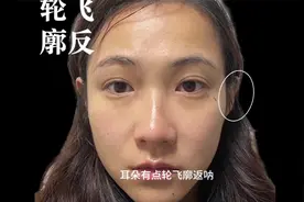 女人面相这里越大，老公越能发大财，天生老板娘的命！视频封面